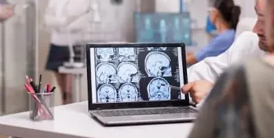 Person looking at brain scans.