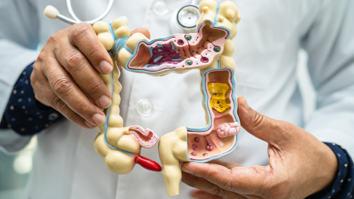 doctor holding a figure of a colon
