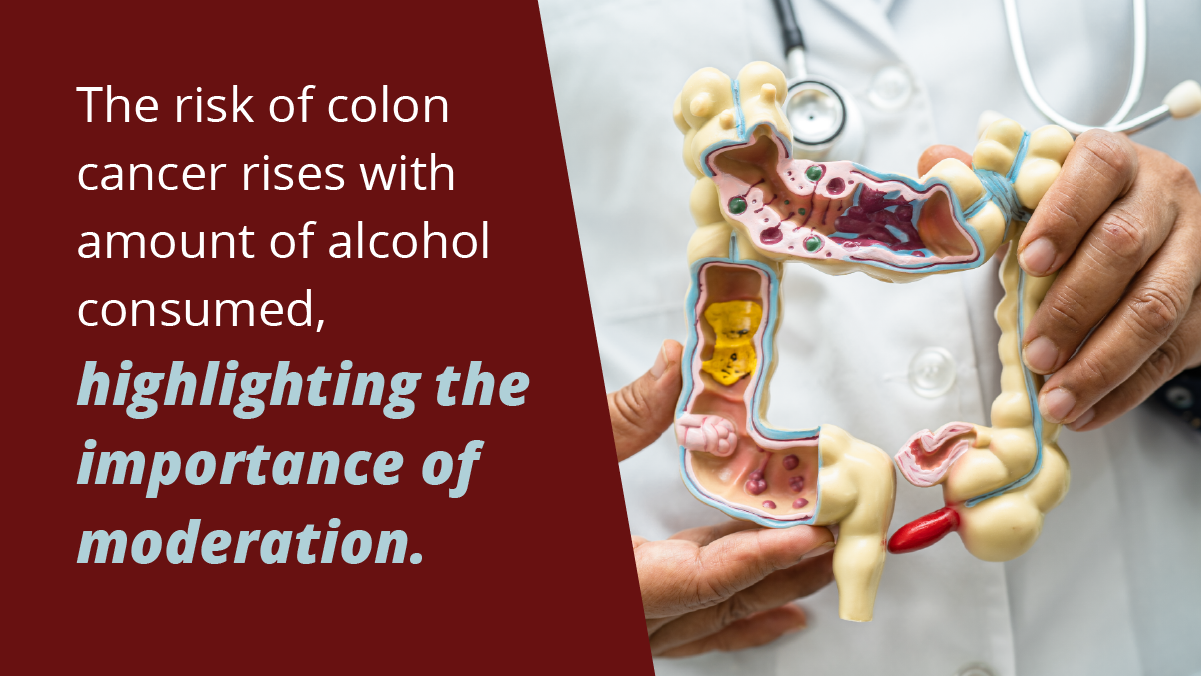 Illustration depicting the link between alcohol consumption and colon cancer risk