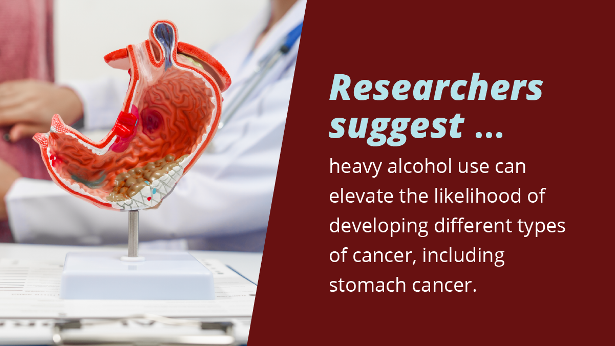 Researchers suggest that heavy alcohol use can elevate the likelihood of developing different types of cancer, including stomach cancer.
