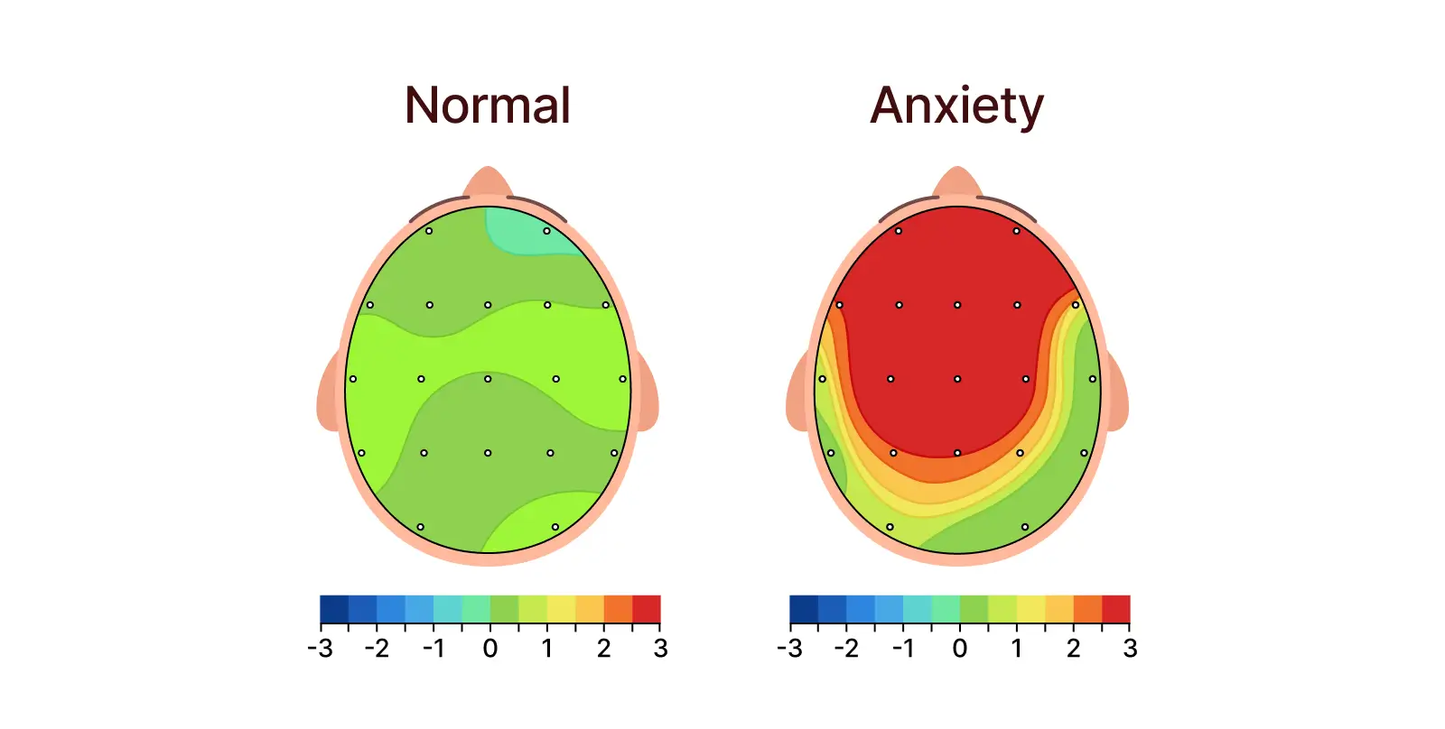 Anxiety symptoms such as racing thoughts, constant worry, or feeling on edge are often tied to overactive threat and alert systems in the brain