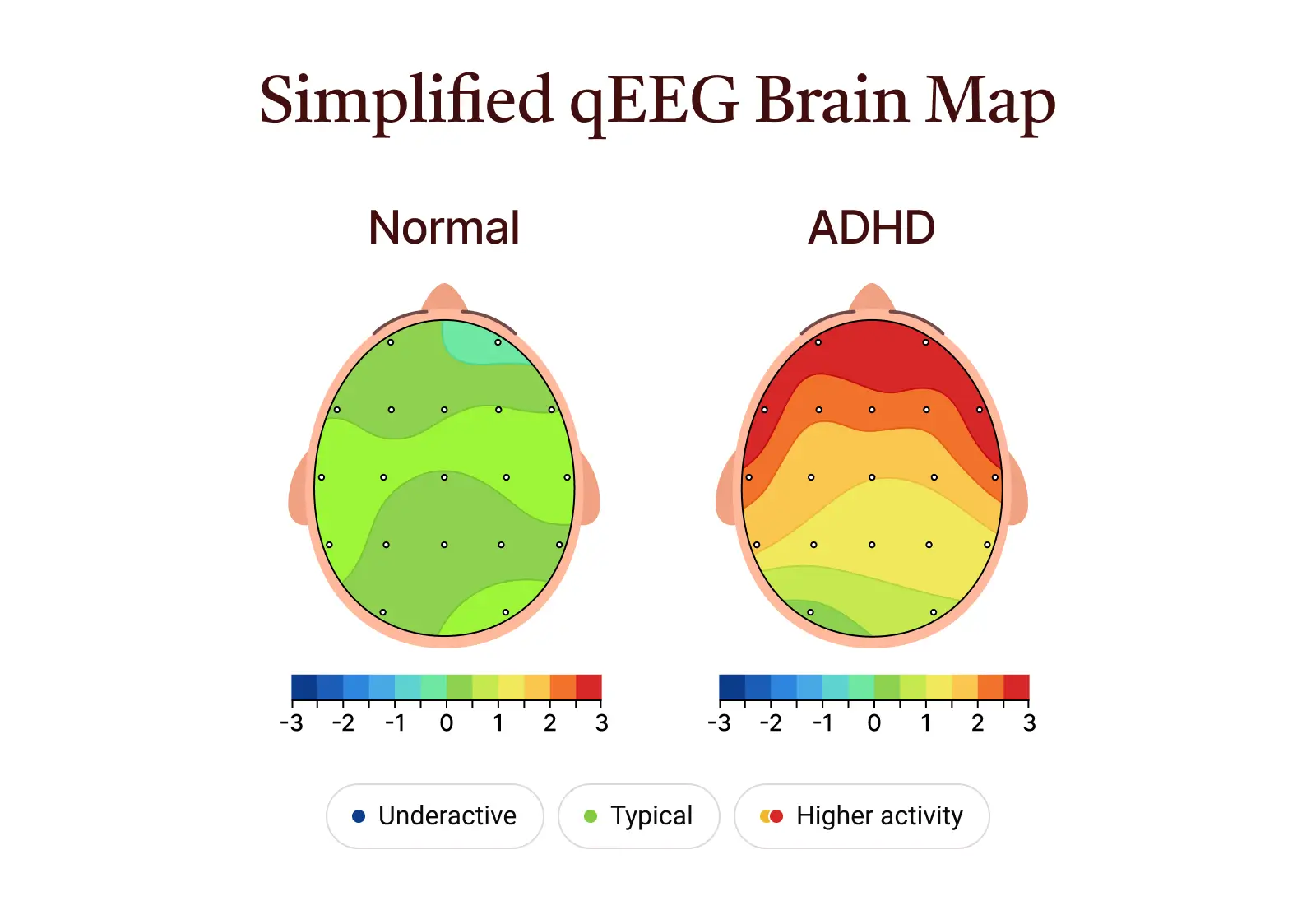Simplified qEEG Brain Map
