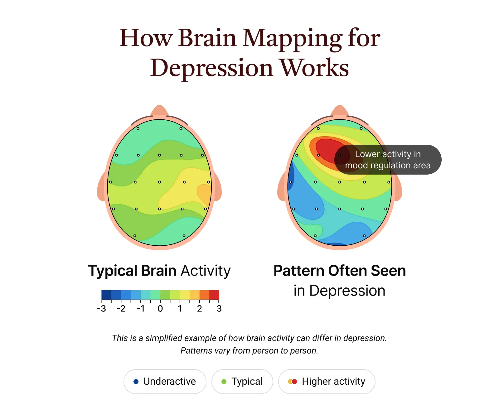 Brain mapping looks at how different areas of your brain are functioning and how they work together