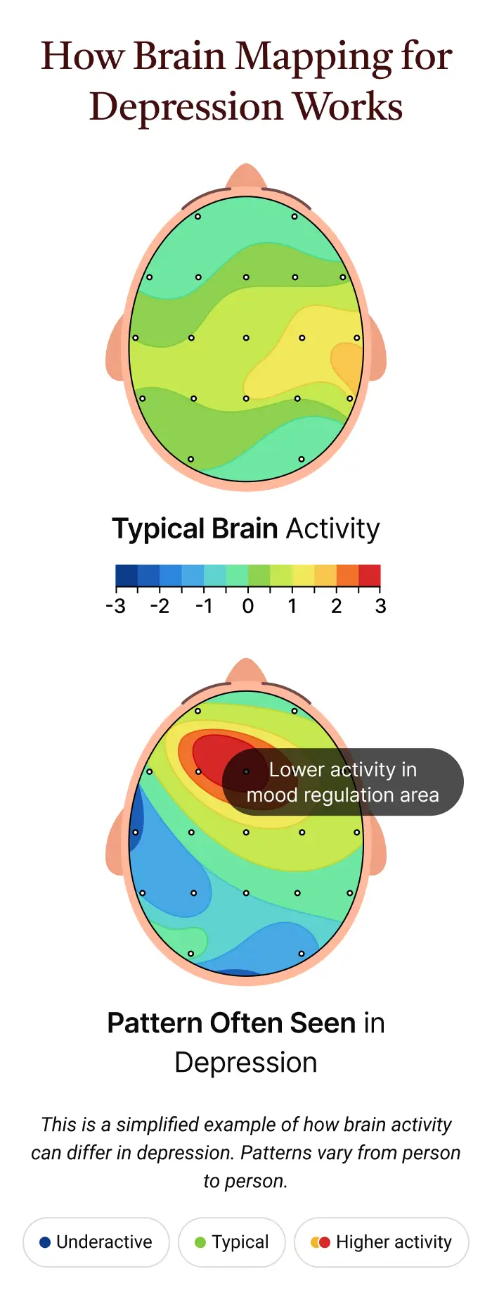 Brain mapping looks at how different areas of your brain are functioning and how they work together