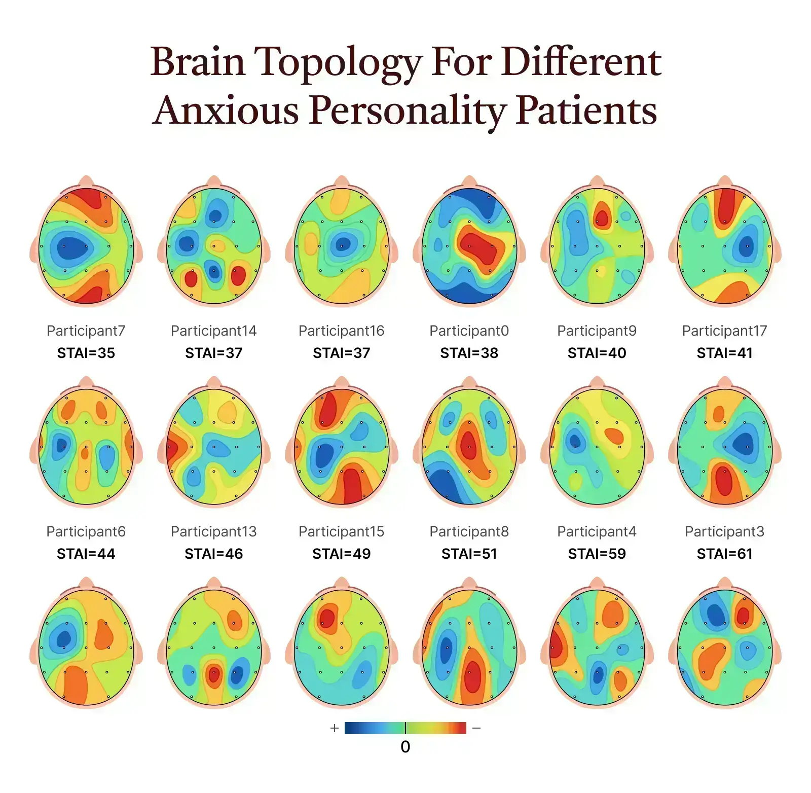 Brain mapping helps identify which pattern is present so treatment can be more focused and intentional. Instead of guessing, it shows how your brain is actually functioning in real time