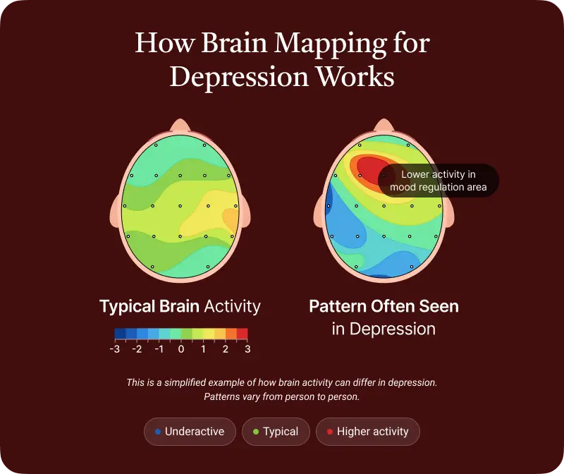 Brain mapping looks at how different areas of your brain are functioning and how they work together