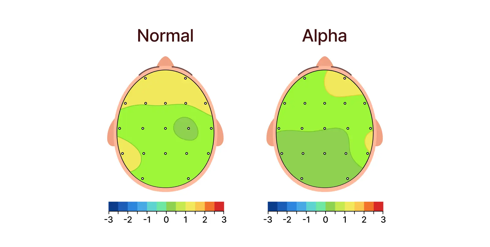 Alpha waves are associated with relaxed wakefulness